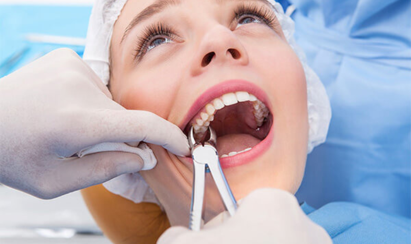 Taking Care After Tooth Extraction A Guide to What You Consume