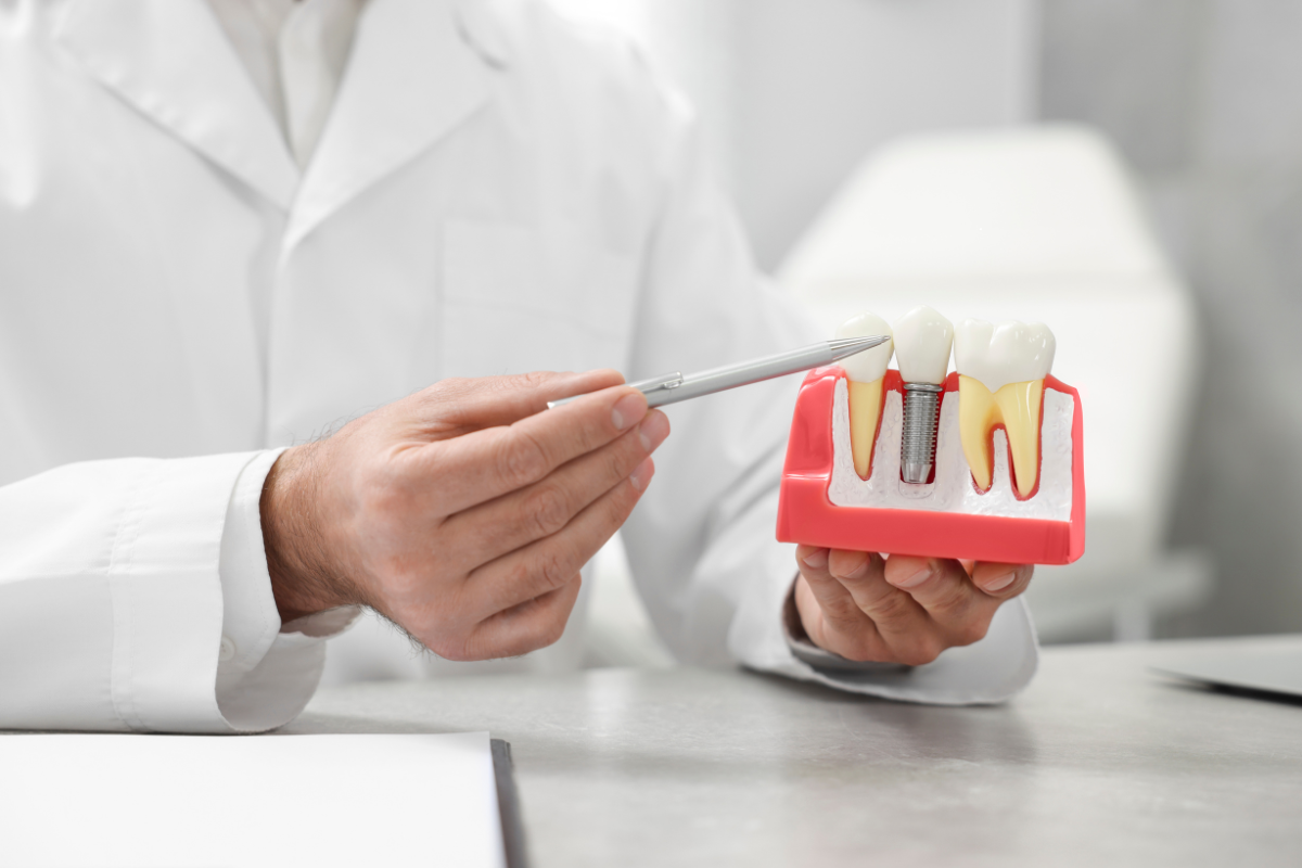 Dental Implant